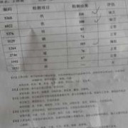 宝宝检查微量元素挂什么科呢？是不是挂儿科,胎儿肢体缺如发生概率