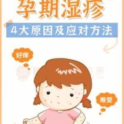 孕期湿疹产后怎么办（孕期湿疹产后怎么办）