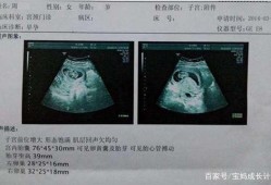 刚出生的婴儿怎么辨别男孩女孩,胎儿男女怎么看b超单