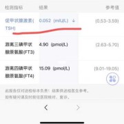 tsh偏低对胎儿的影响（tsh偏低对胎儿有影响吗）