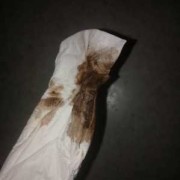 怀孕期间出血是黑色的（怀孕了一直有褐色的血怎么回事）