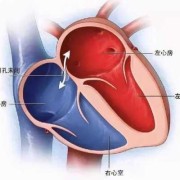 胎儿卵圆孔偏大（胎儿卵圆孔偏大是什么原因造成的）