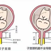 26周宫颈管26mm是不是太短了需要保胎吗,胎儿26mm是多大