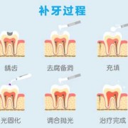 备孕期可以补牙吗（备孕期可以补牙吗补牙会打麻药对胎儿有影响吗）