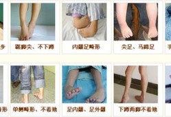 怀孕脑瘫是怎么形成的,胎儿脑瘫的原因有哪些