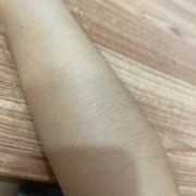 孕期体毛变少已知是男（男性彻底女性化后会变成女生吗）