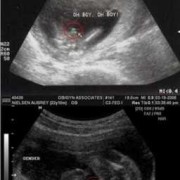 胎儿不爱动是男是女（胎儿不爱动是男是女宝宝）