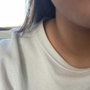 孕妇脖子变黑是怎么回事呢？正常的吗,孕期黑色素沉淀的原因有哪些