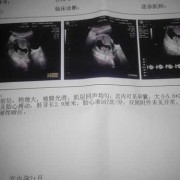 怀孕二十二周胎儿多大（怀孕22周胎心一直104左右正常吗）