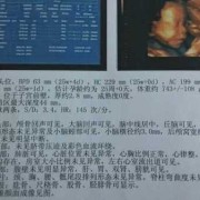 孕24周胎儿小脑横径是怎么回事呢？医生也没有说有什么问题,孕24周胎儿发育指标数据表