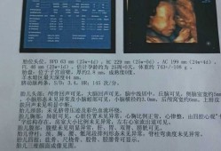 孕24周胎儿小脑横径是怎么回事呢？医生也没有说有什么问题,孕24周胎儿发育指标数据表