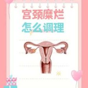 孕期如何治疗宫颈糜烂（孕期如何治疗宫颈糜烂呢）