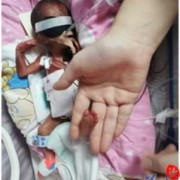 孕24周的胎儿图片（孕24周的胎儿图片大全）