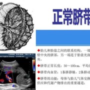 胎儿脐动脉两条是什么意思,胎儿双动脉是什么意思