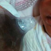 母乳喂奶乳头破皮流血了怎么办,孕期乳晕破皮流水抹乳汁有用吗