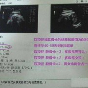 胎儿肱骨长偏短怎么办（在怀孕28周的时候胎儿股骨长偏短会影响发育吗）