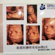 孕24周四维彩超检查主要是看什么,胎儿24周四维彩超图片