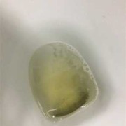孕期尿有泡沫（孕期尿有泡沫是什么问题）