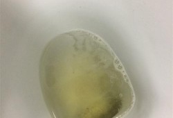 孕期尿有泡沫（孕期尿有泡沫是什么问题）