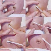 胎儿拱肚脐（胎儿拱肚脐眼怎么回事）