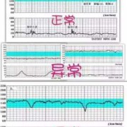 30周胎儿视频（孕三十周多，做胎心监护胎心率160左右。正常吗）