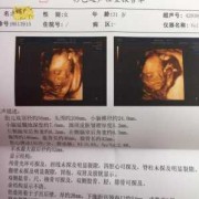 孕24周的四维彩超各项正常值是多少,孕24周胎儿生长指标对照表