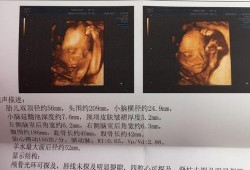 孕24周的四维彩超各项正常值是多少,孕24周胎儿生长指标对照表