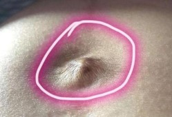 孕妇肚脐眼发臭对胎儿（肚脐很臭是怎么回事）