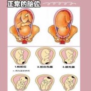 胎儿枕左前位图片（胎儿枕左前位的图片）