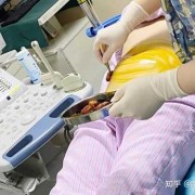 怀孕期间做什么检查（怀孕期间做什么检查可以查孩子智力）