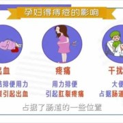 孕期痔疮严重（孕期痔疮严重怎么办）