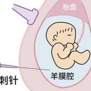 胎儿肠管回声稍增强（胎儿腹部肠管回声增强必须做羊穿吗）
