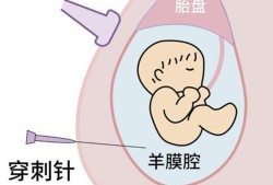 胎儿肠管回声稍增强（胎儿腹部肠管回声增强必须做羊穿吗）