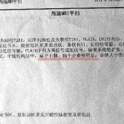 胎儿头颅磁共振报告单（胎儿头颅磁共振报告单自己能看懂吗）