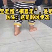 宝宝八个月了，走路一只脚横着往外，问题大吗,胎儿脚出来了,情况紧急