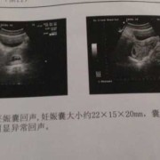 孕期第一天（上班第一天发现怀孕了怎么辞）