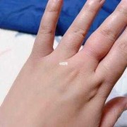 孕期右手肿（孕妇手肿是什么原因）