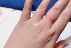 孕期右手肿（孕妇手肿是什么原因）