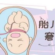 慢性胎儿窘迫原因（慢性胎儿窘迫原因有哪些）