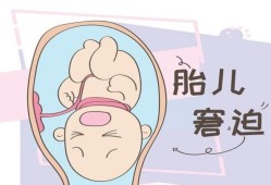 慢性胎儿窘迫原因（慢性胎儿窘迫原因有哪些）