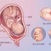 帆状胎盘的胎儿能要吗（帆状胎盘对胎儿有影响吗）