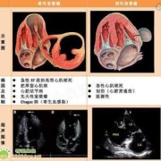 胎儿左心室强光点（胎儿左心室强光点是什么意思）