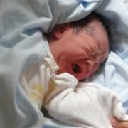 为什么有的婴儿一出生就有鼻梁,胎儿没鼻梁骨说明孩子痴呆