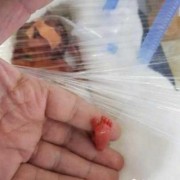 印度胎儿（印度出生的宝宝是什么颜色）