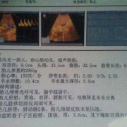 四维B超单上写着胎儿生物物理相评分8分是什么意思,胎儿超声生物物理评分8分正常吗