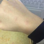 刚出生的猫宝宝被母猫咬伤怎么办,孕期被猫咬了影响胎儿吗