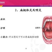 咽炎对胎儿有影响吗（孕妇咽炎对胎儿有影响吗）