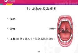 咽炎对胎儿有影响吗（孕妇咽炎对胎儿有影响吗）