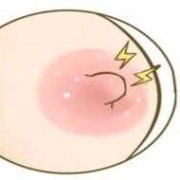 备孕期乳头痒（怀孕后乳头痒怎么办）