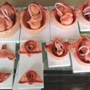 胎儿声音（胎儿声音刺激试验是什么检查）